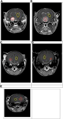 Simultaneous Dual Echo Gadolinium Enhanced MR-PET for Evaluation of PET Tracer Delivery in Altered Pathophysiology